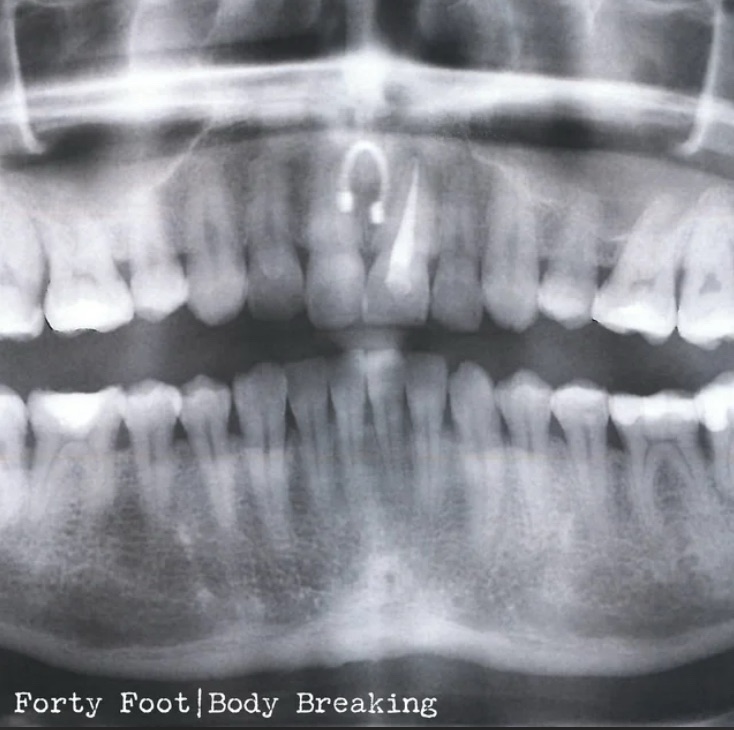 Nothing Short of Brilliant: Forty Foot – ‘Body Breaking’&nbsp;Review